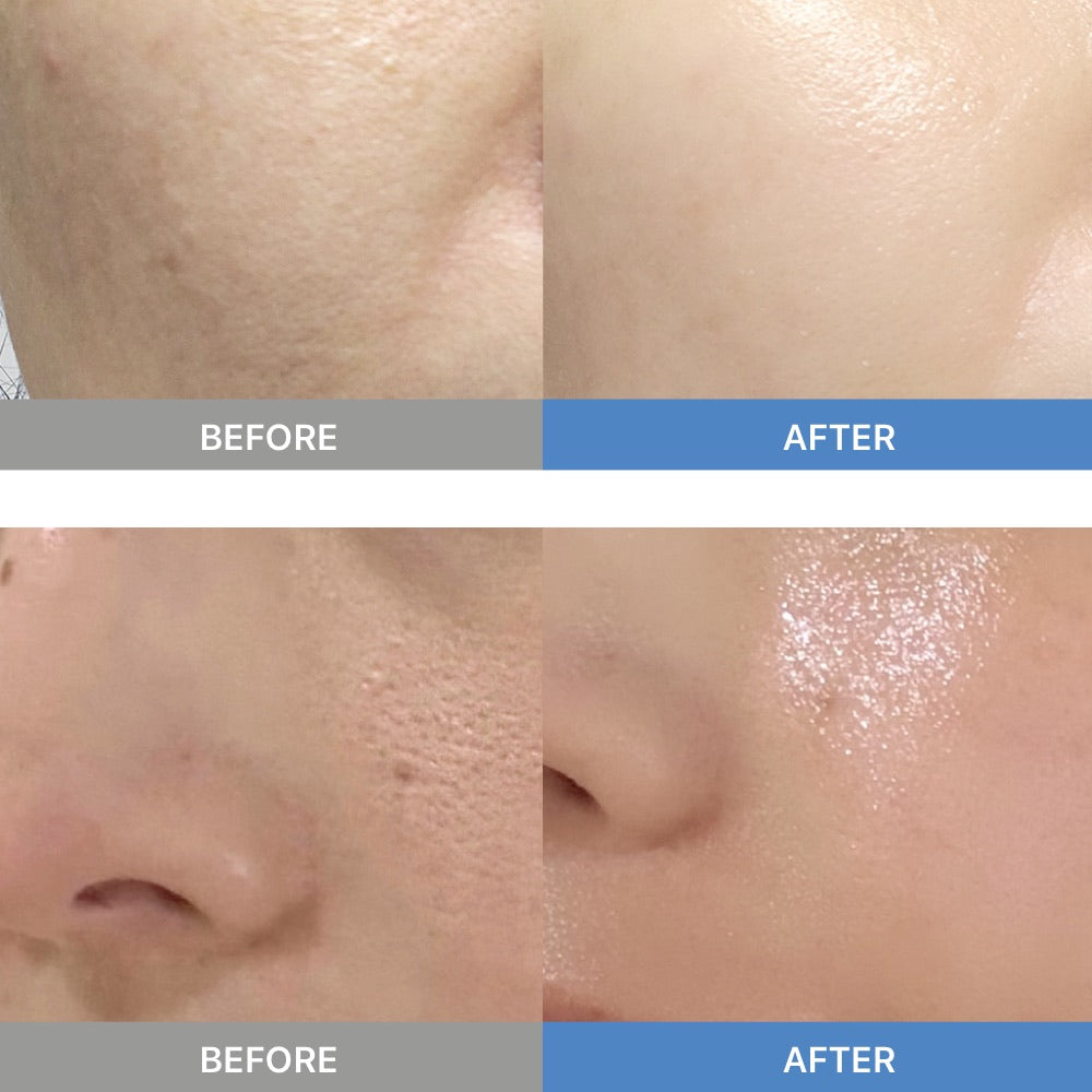 Microbiome Probiotic Mask