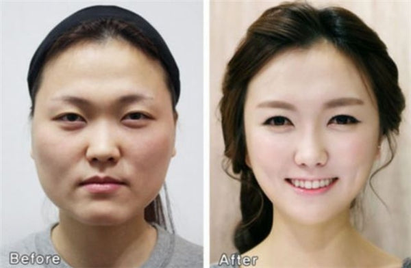 Glowing Skin, New Face: The Passport Hurdle in Korea’s Beauty Tourism
