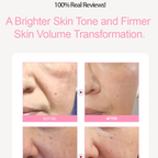A picture of a website page for a skincare product, showing before-and-after facial skin comparison photos, pink promotional text, and product packaging images on the left. The screenshot is taken from a Chrome browser with a macOS dock visible at the bottom.