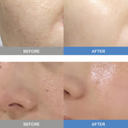 Sunnicorn Microbiome Collagen Mask