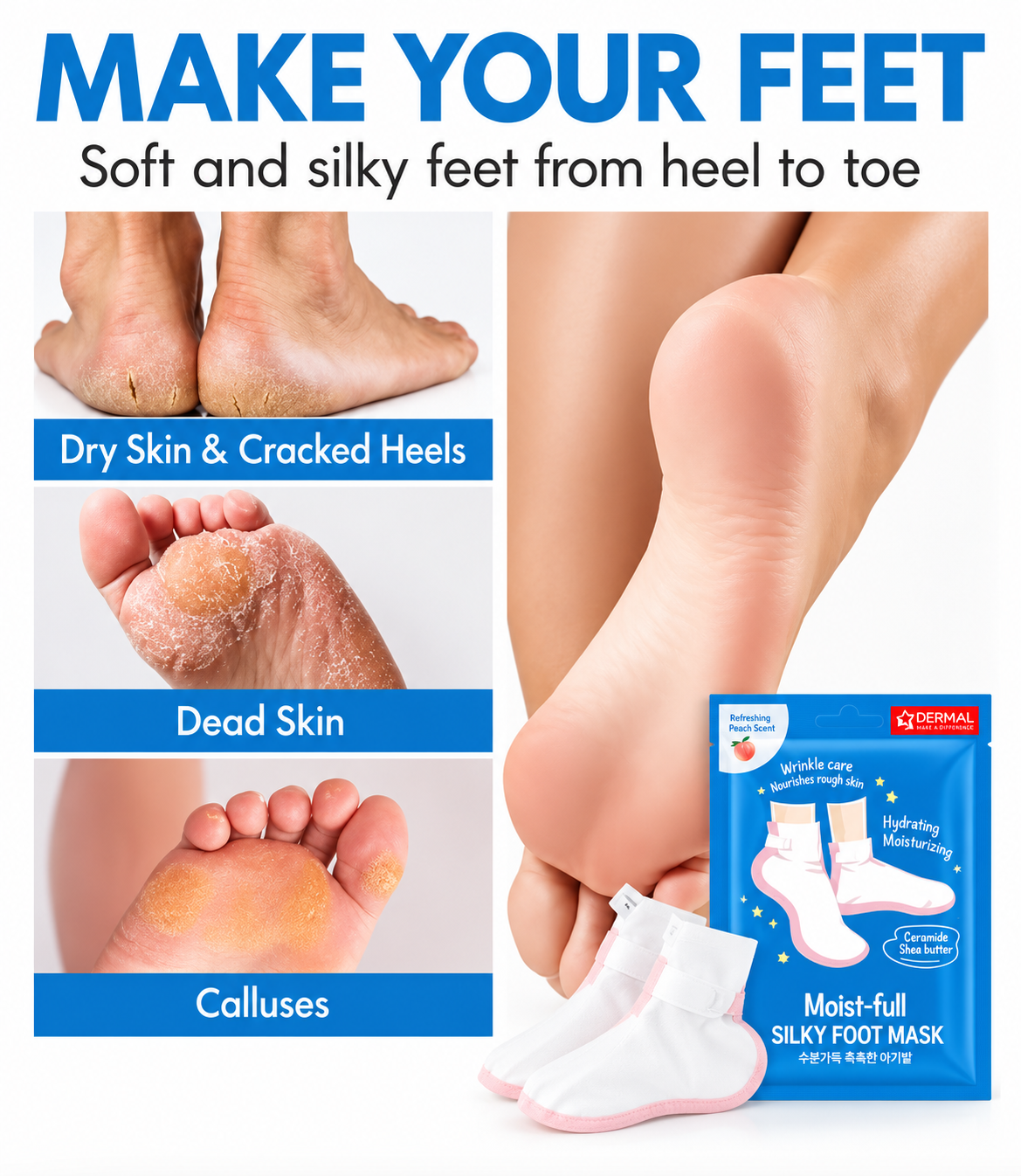 Promotional collage for a foot care product showing bare feet with dry, cracked, and callused heels, a close-up of a foot being pulled toward the calf, a blue packet labeled OTCURAL Moist-full Silky Foot Mask, and large headline text reading 'MAKE YOUR FEET Soft and silky feet from heel to toe.'.