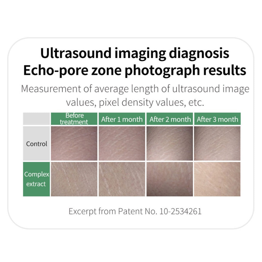 Lalucell Anti-Stretch Mark Patch