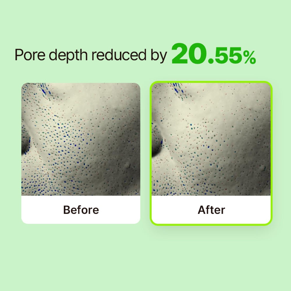 RETURNU Pore Shooter Gommage Cleansing Balm