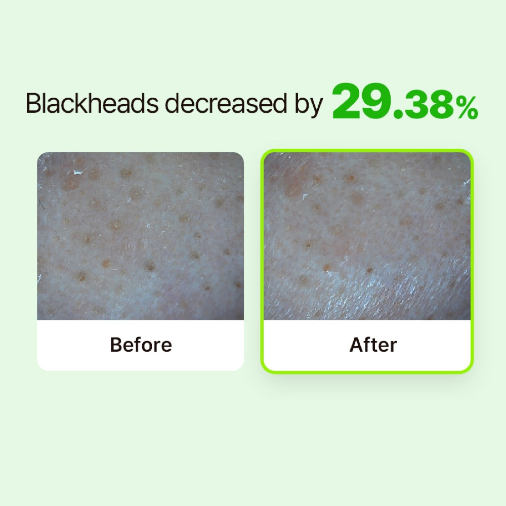 RETURNU Pore Shooter Gommage Cleansing Balm