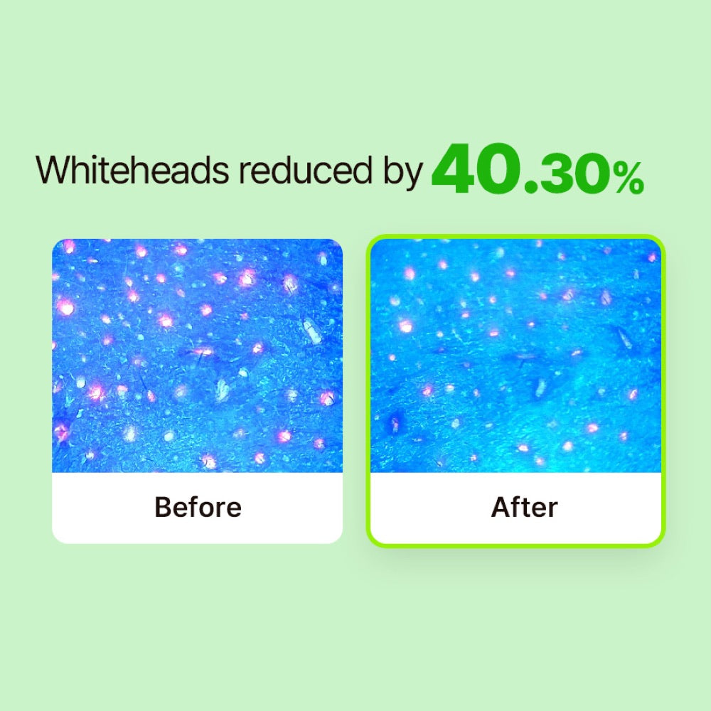 RETURNU Pore Shooter Gommage Cleansing Balm