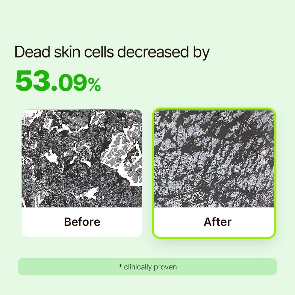 RETURNU Pore Shooter Gommage Cleansing Balm